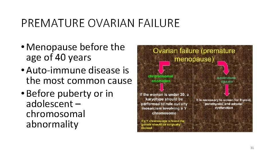 PREMATURE OVARIAN FAILURE • Menopause before the age of 40 years • Auto-immune disease