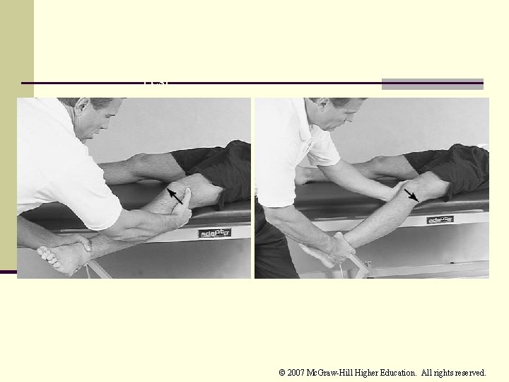 Valgus Stress Test Varus Stress Test © 2007 Mc. Graw-Hill Higher Education. All rights