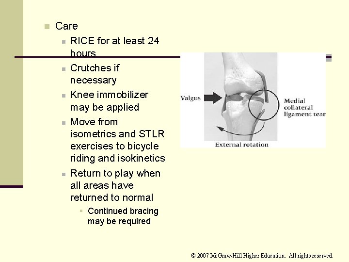 n Care n RICE for at least 24 hours n Crutches if necessary n