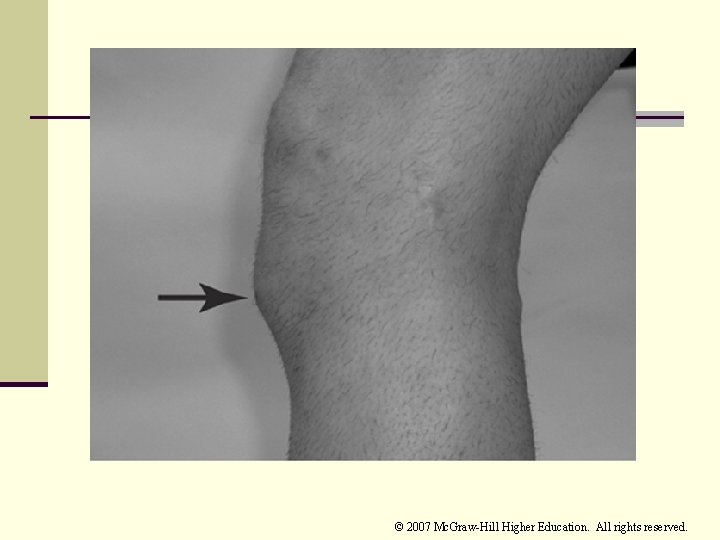 © 2007 Mc. Graw-Hill Higher Education. All rights reserved. 