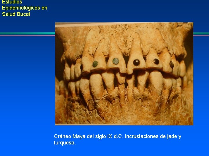 Estudios Epidemiológicos en Salud Bucal Cráneo Maya del siglo IX d. C. Incrustaciones de