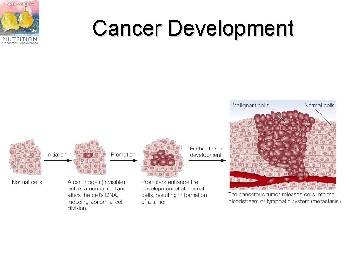 Cancer Development 