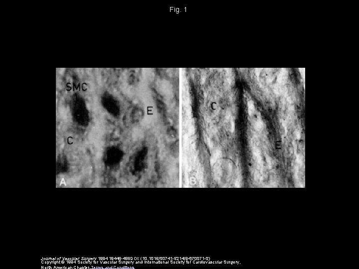 Fig. 1 Journal of Vascular Surgery 1994 19446 -456 DOI: (10. 1016/S 0741 -5214(94)70071