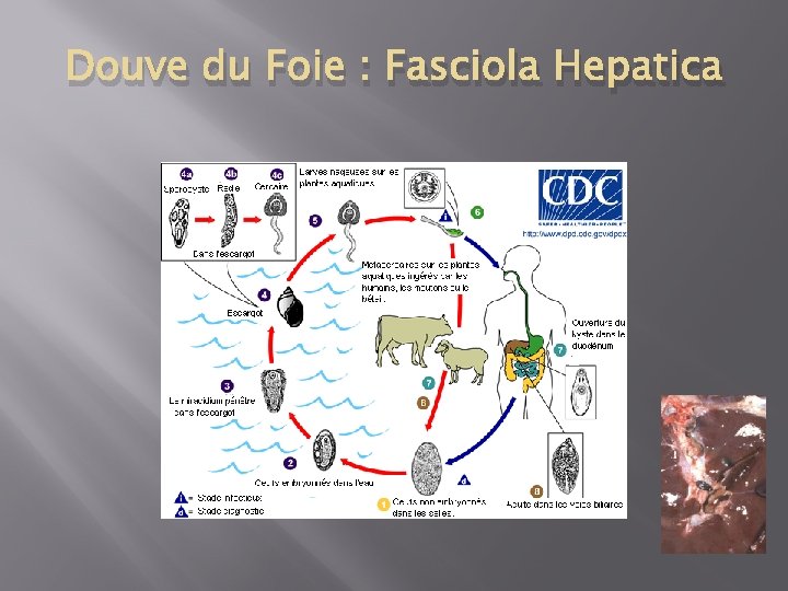Douve du Foie : Fasciola Hepatica 