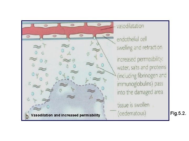 Vasodilation and increased permiability Fig. 5. 2. 