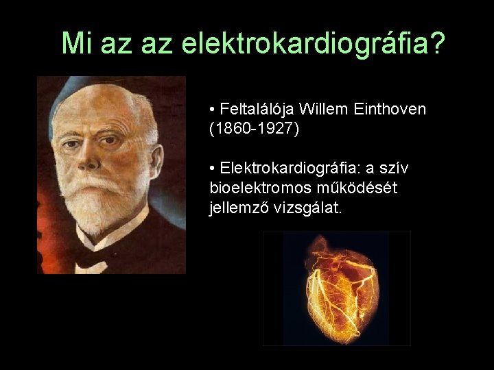 Mi az az elektrokardiográfia? • Feltalálója Willem Einthoven (1860 -1927) • Elektrokardiográfia: a szív