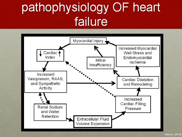 pathophysiology OF heart failure (Marino, 2014) 