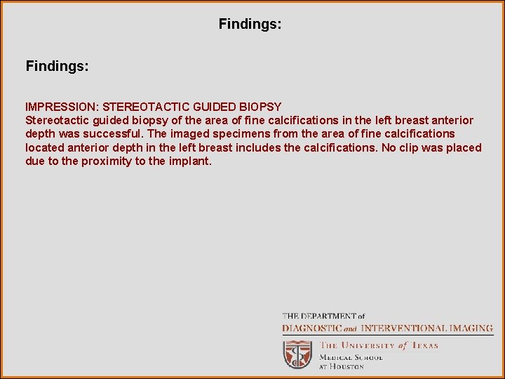 Findings: IMPRESSION: STEREOTACTIC GUIDED BIOPSY Stereotactic guided biopsy of the area of fine calcifications