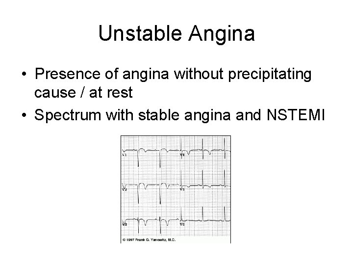 Unstable Angina • Presence of angina without precipitating cause / at rest • Spectrum