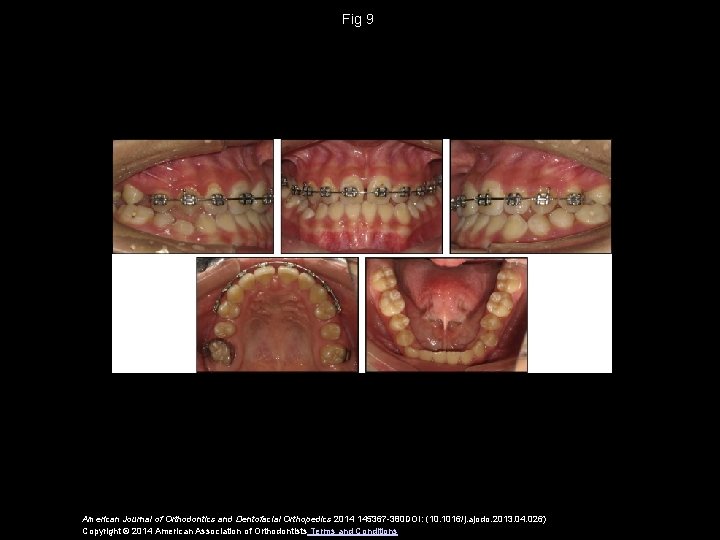 Fig 9 American Journal of Orthodontics and Dentofacial Orthopedics 2014 145367 -380 DOI: (10.
