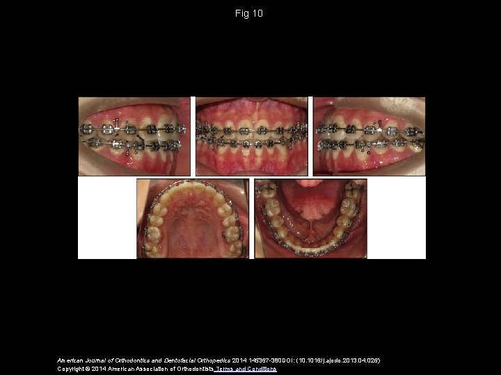 Fig 10 American Journal of Orthodontics and Dentofacial Orthopedics 2014 145367 -380 DOI: (10.