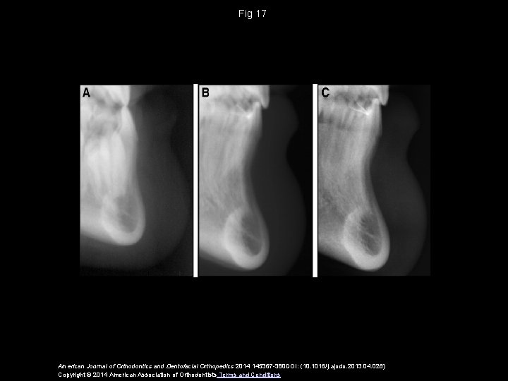 Fig 17 American Journal of Orthodontics and Dentofacial Orthopedics 2014 145367 -380 DOI: (10.