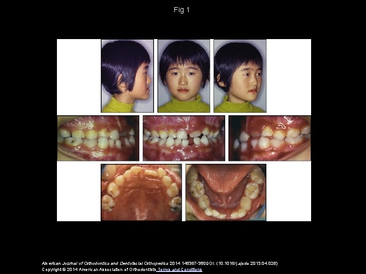 Fig 1 American Journal of Orthodontics and Dentofacial Orthopedics 2014 145367 -380 DOI: (10.