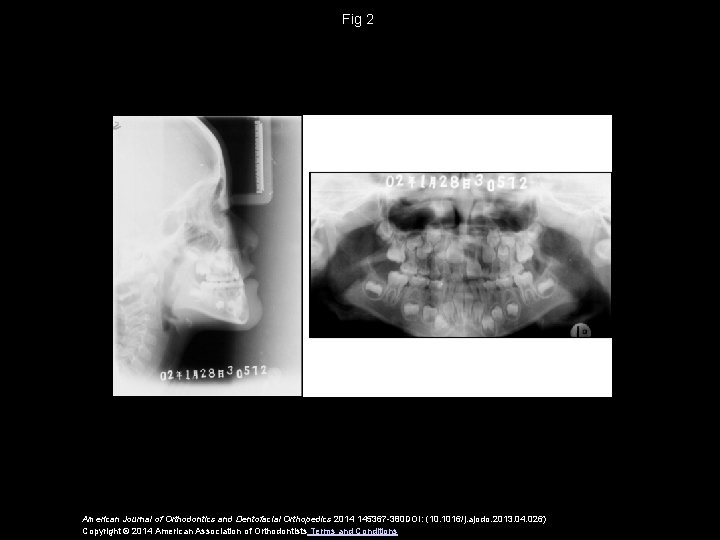 Fig 2 American Journal of Orthodontics and Dentofacial Orthopedics 2014 145367 -380 DOI: (10.