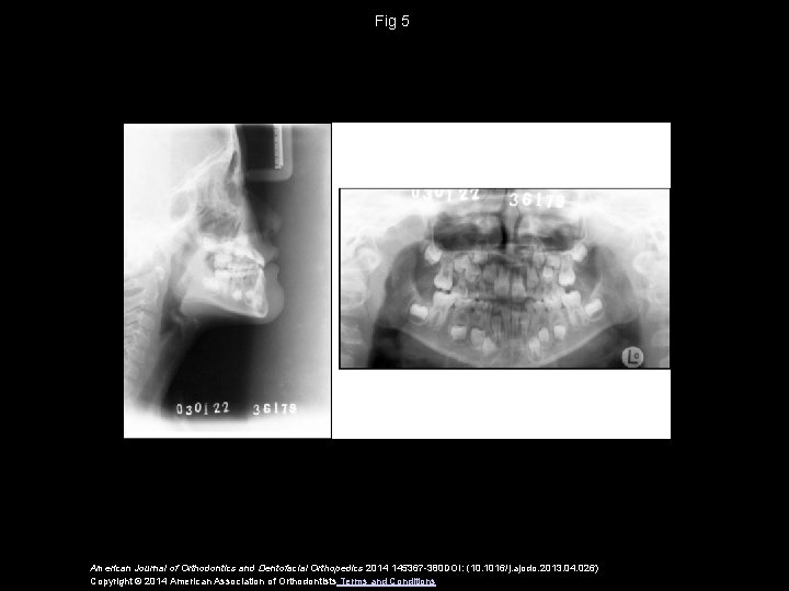 Fig 5 American Journal of Orthodontics and Dentofacial Orthopedics 2014 145367 -380 DOI: (10.