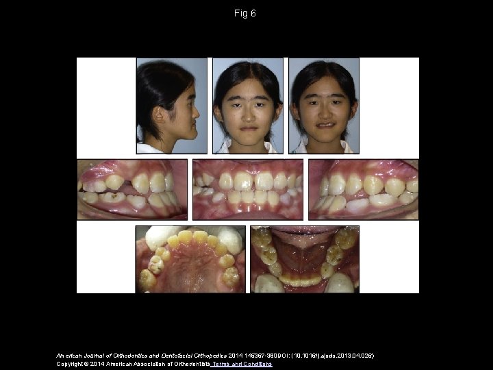 Fig 6 American Journal of Orthodontics and Dentofacial Orthopedics 2014 145367 -380 DOI: (10.