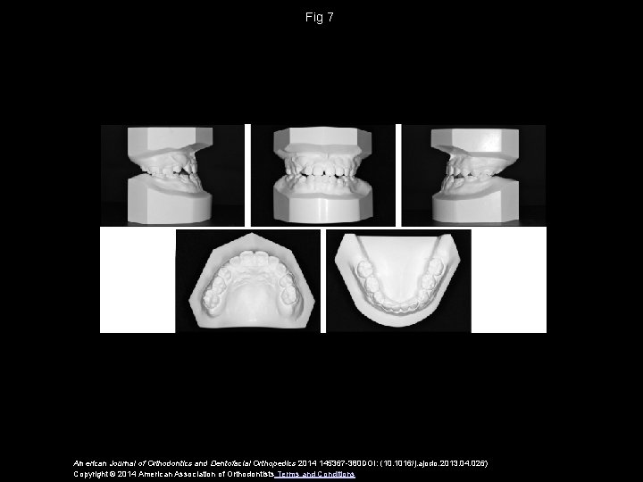 Fig 7 American Journal of Orthodontics and Dentofacial Orthopedics 2014 145367 -380 DOI: (10.