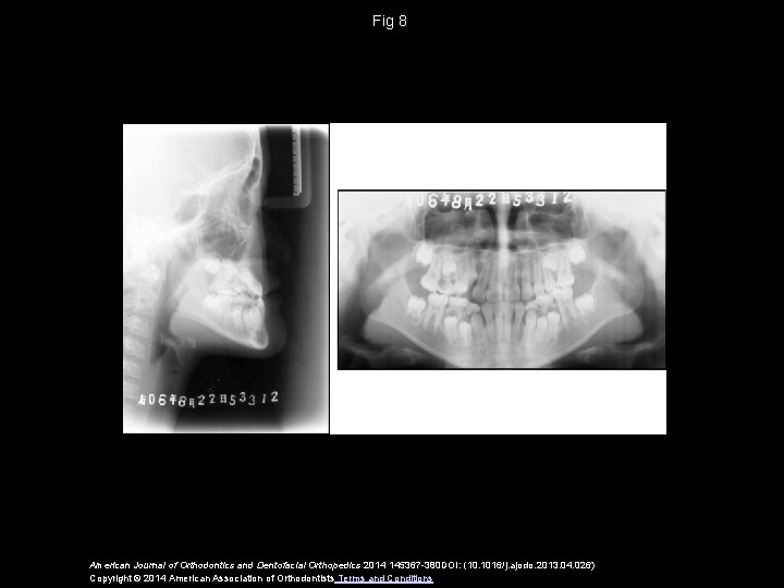 Fig 8 American Journal of Orthodontics and Dentofacial Orthopedics 2014 145367 -380 DOI: (10.