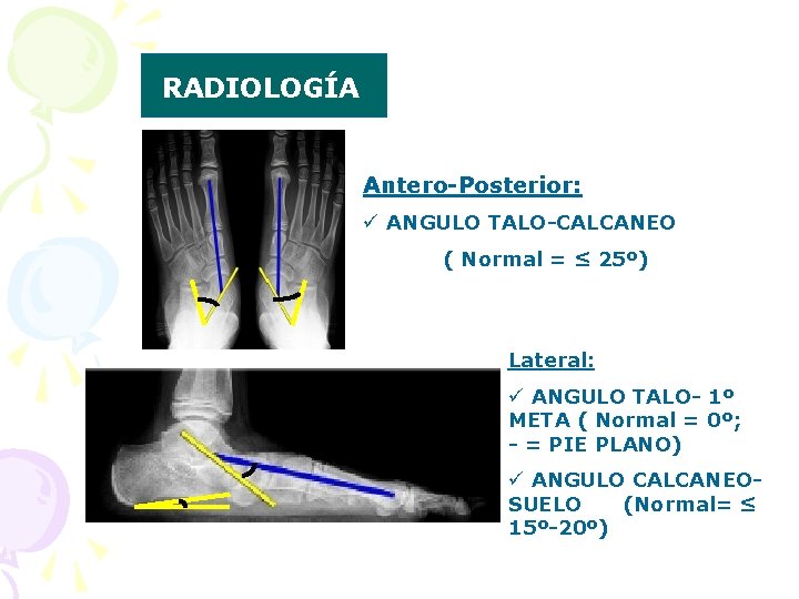 RADIOLOGÍA Antero-Posterior: ü ANGULO TALO-CALCANEO ( Normal = ≤ 25º) Lateral: ü ANGULO TALO-