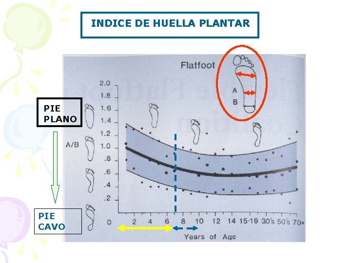 INDICE DE HUELLA PLANTAR PIE PLANO PIE CAVO 