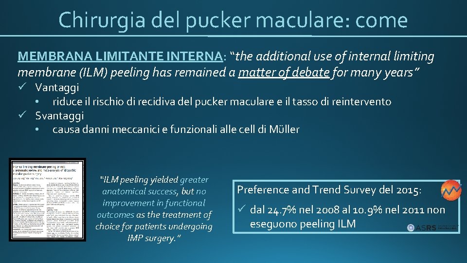 Chirurgia del pucker maculare: come MEMBRANA LIMITANTE INTERNA: “the additional use of internal limiting