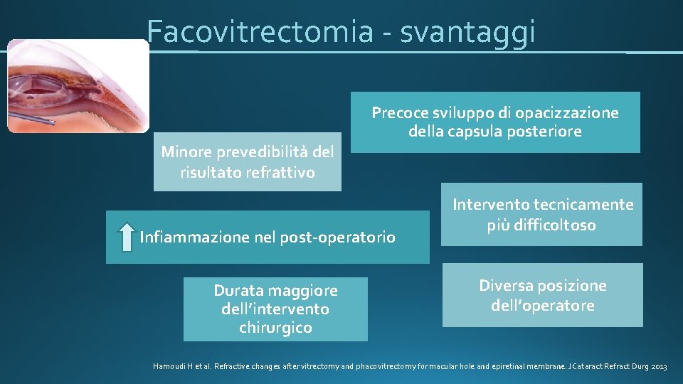 Facovitrectomia - svantaggi Minore prevedibilità del risultato refrattivo Precoce sviluppo di opacizzazione della capsula