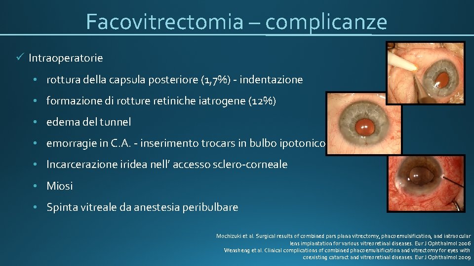 Facovitrectomia – complicanze ü Intraoperatorie • rottura della capsula posteriore (1, 7%) - indentazione