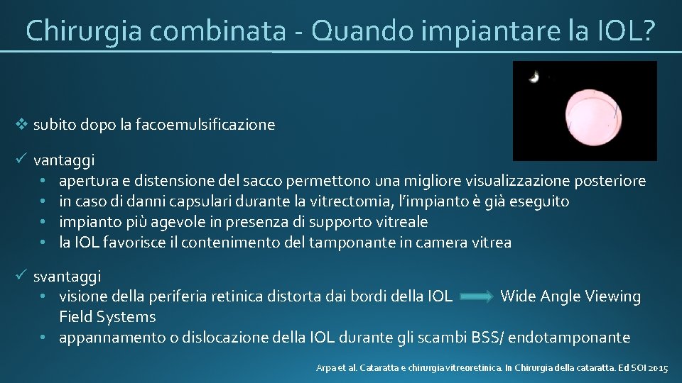 Chirurgia combinata - Quando impiantare la IOL? v subito dopo la facoemulsificazione ü vantaggi