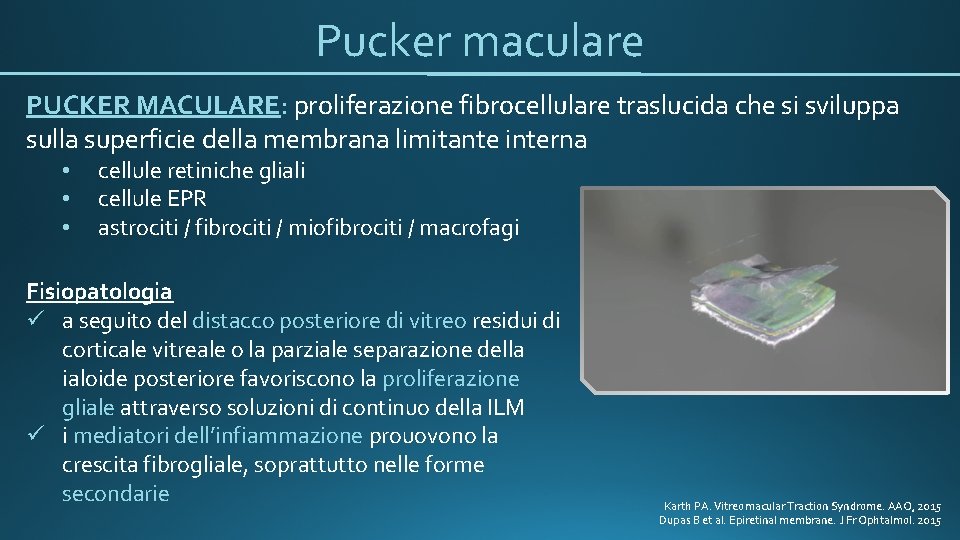 Pucker maculare PUCKER MACULARE: proliferazione fibrocellulare traslucida che si sviluppa sulla superficie della membrana