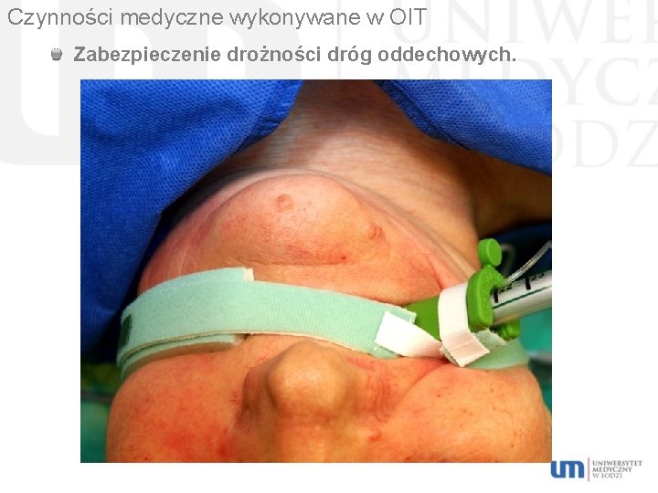 Czynności medyczne wykonywane w OIT Zabezpieczenie drożności dróg oddechowych. 