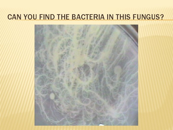 CAN YOU FIND THE BACTERIA IN THIS FUNGUS? 