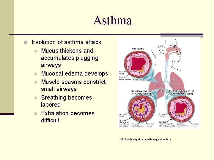 Asthma n Evolution of asthma attack n n n Mucus thickens and accumulates plugging
