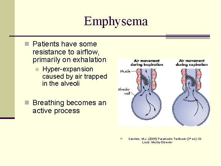 Emphysema n Patients have some resistance to airflow, primarily on exhalation n Hyper-expansion caused