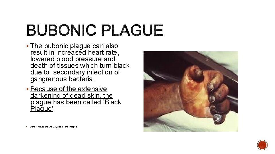 § The bubonic plague can also result in increased heart rate, lowered blood pressure § The bubonic plague can also result in increased heart rate, lowered blood pressure