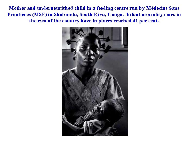 Mother and undernourished child in a feeding centre run by Médecins Sans Frontières (MSF)