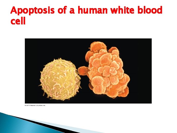 Apoptosis of a human white blood cell 