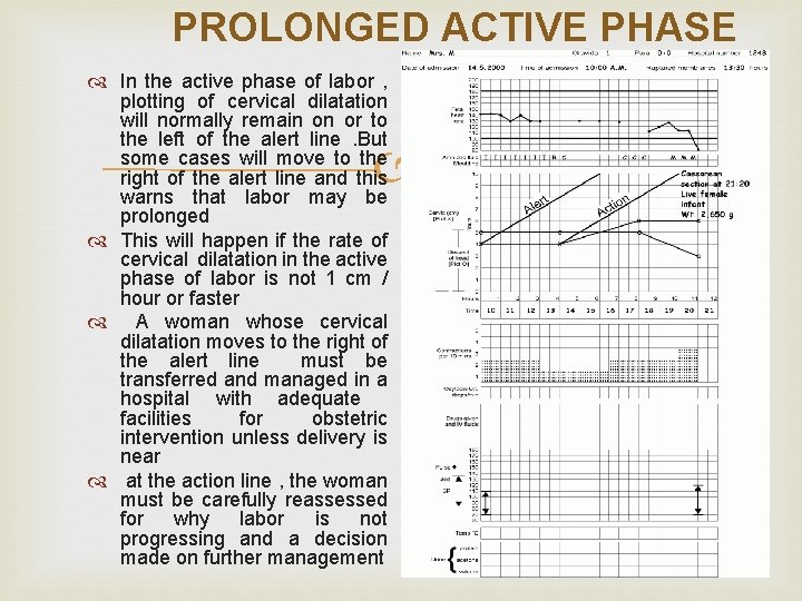 PROLONGED ACTIVE PHASE In the active phase of labor , plotting of cervical dilatation