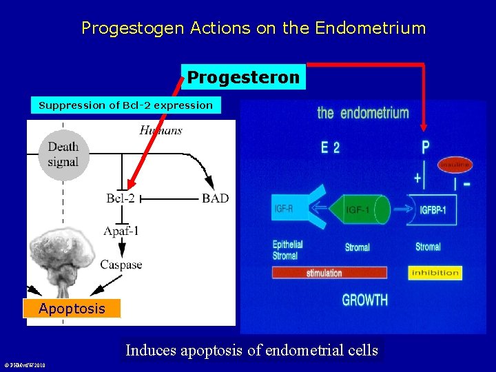 Progestogen Actions on the Endometrium Progesteron Suppression of Bcl-2 expression Apoptosis Induces apoptosis of