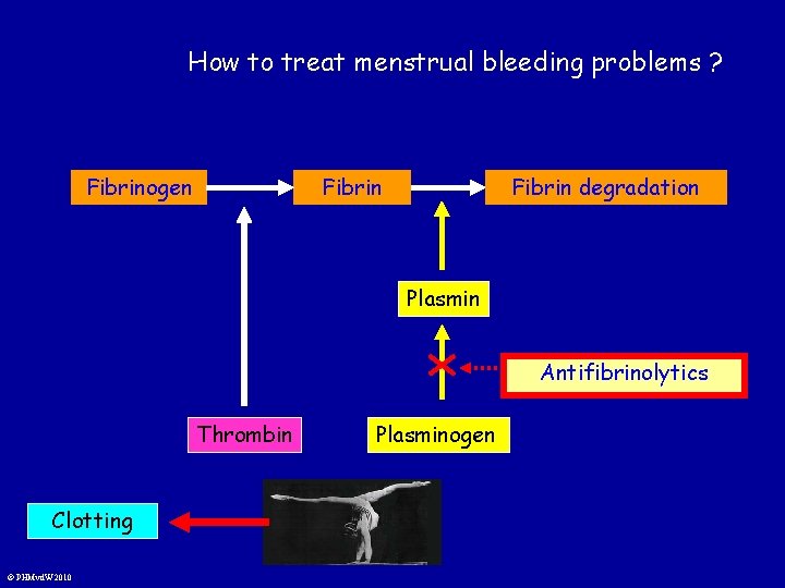 How to treat menstrual bleeding problems ? Fibrinogen Fibrin degradation Plasmin Antifibrinolytics Thrombin Clotting