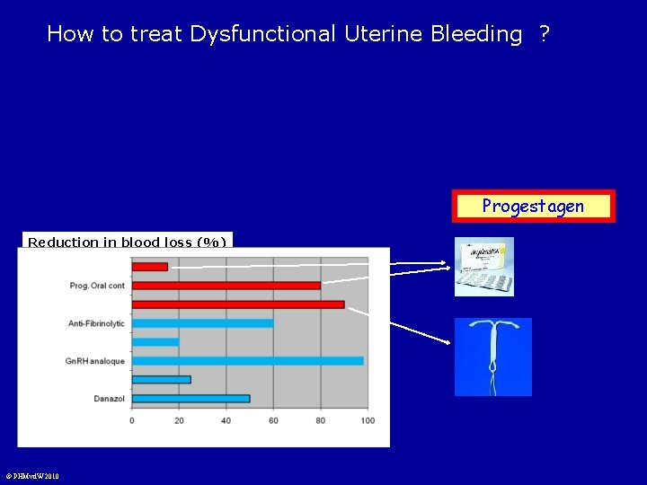 How to treat Dysfunctional Uterine Bleeding ? Progestagen Reduction in blood loss (%) ©