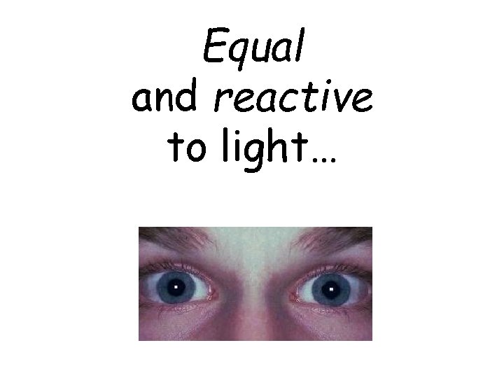 Equal and reactive to light… 