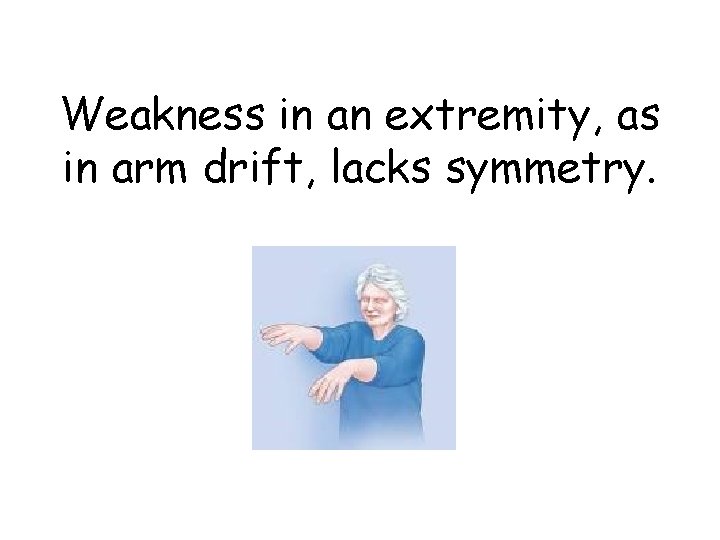 Weakness in an extremity, as in arm drift, lacks symmetry. 