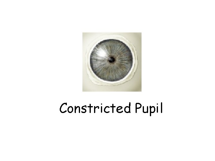 Constricted Pupil 