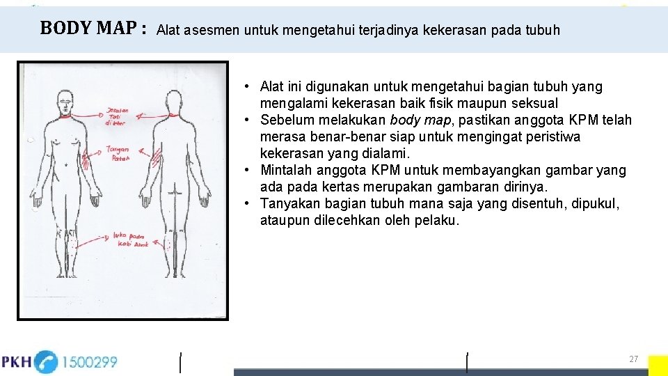 BODY MAP : Alat asesmen untuk mengetahui terjadinya kekerasan pada tubuh • Alat ini