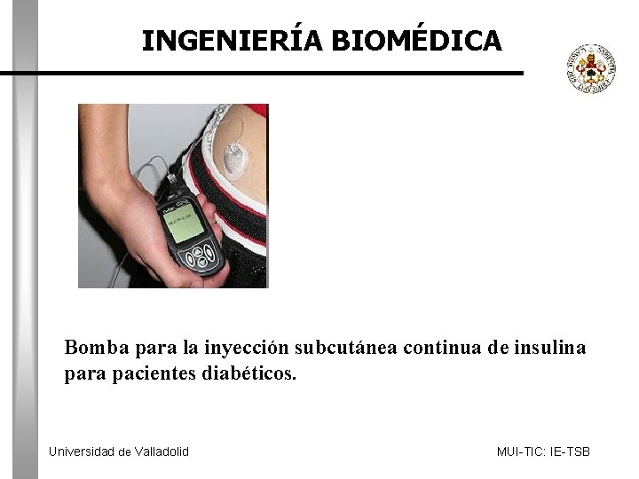 INGENIERÍA BIOMÉDICA Bomba para la inyección subcutánea continua de insulina para pacientes diabéticos. Universidad