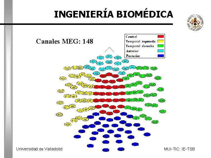 INGENIERÍA BIOMÉDICA Canales MEG: 148 Universidad de Valladolid MUI-TIC: IE-TSB 