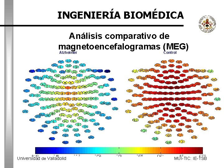 INGENIERÍA BIOMÉDICA Análisis comparativo de magnetoencefalogramas (MEG) Alzheimer Universidad de Valladolid Control MUI-TIC: IE-TSB