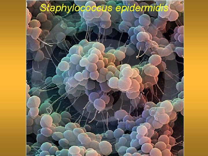 Staphylococcus epidermidis 