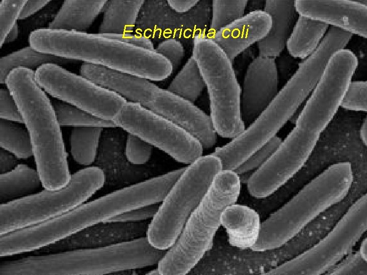 Escherichia coli 