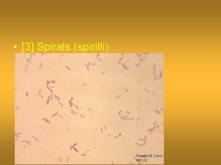  • [3] Spirals (spirilli) 